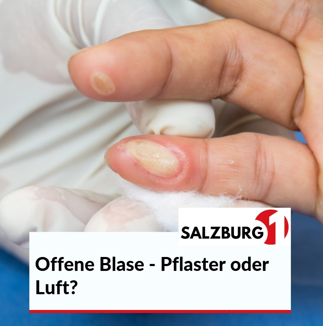 Offene Blase - Pflaster oder Luft Offene Blase - Pflaster oder Luft
